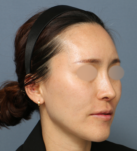 Before 10 45 Degrees