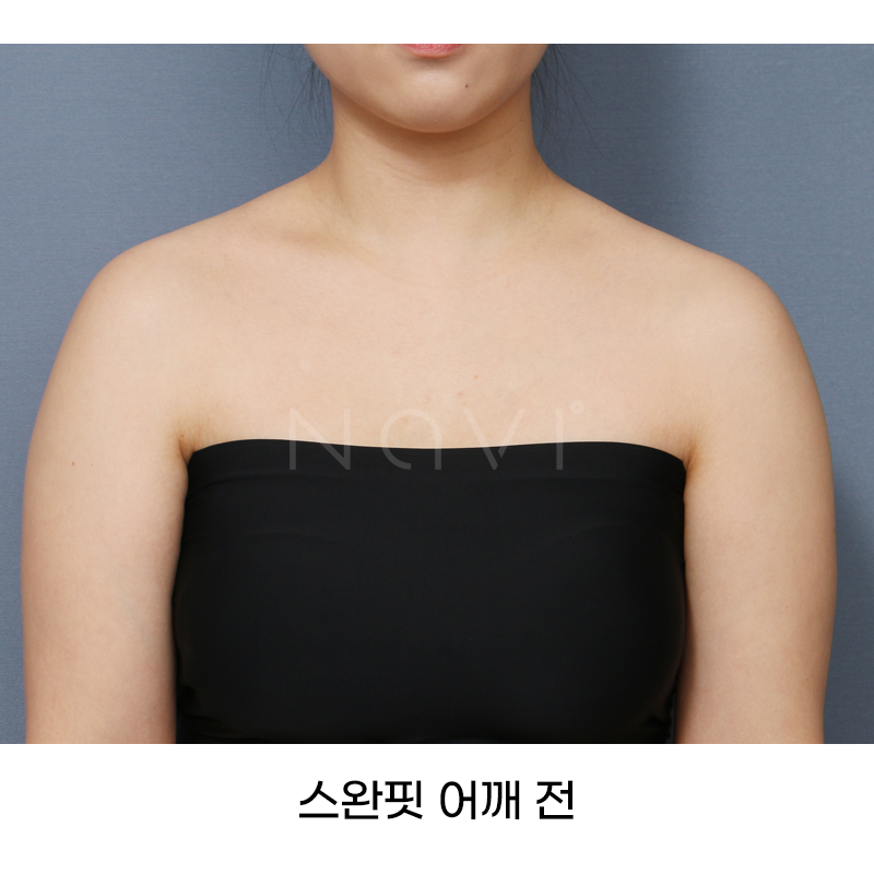 Before 9 Front