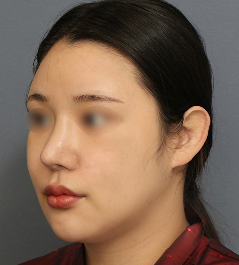 Before 10 45 Degrees