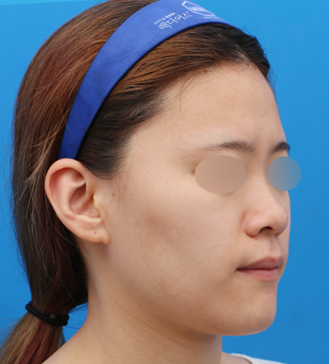 Before 10 45 Degrees