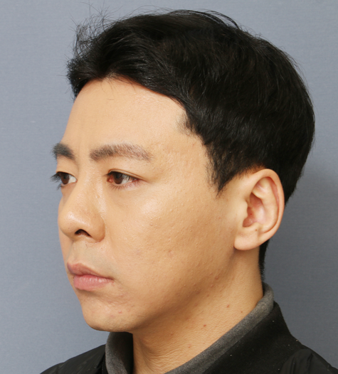 Before 10 45 Degrees