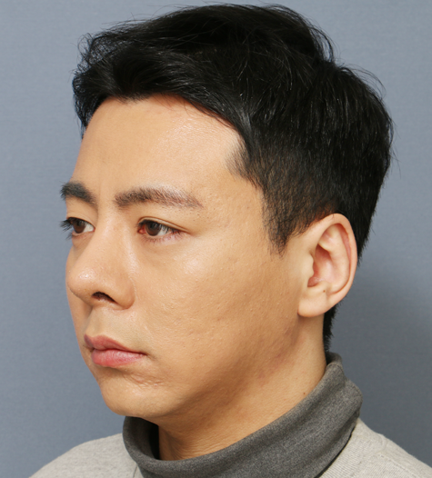 Before 10 45 Degrees