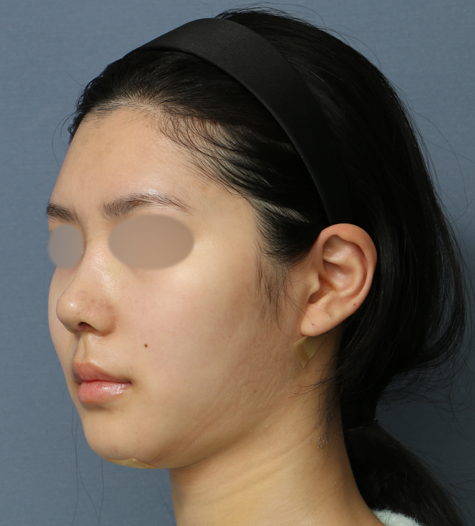 Before 11 45 Degrees