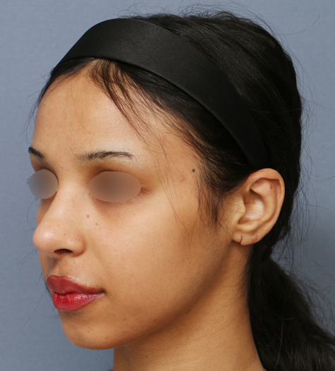 Before 12 45 Degrees