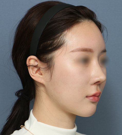 Before 11 45 Degrees