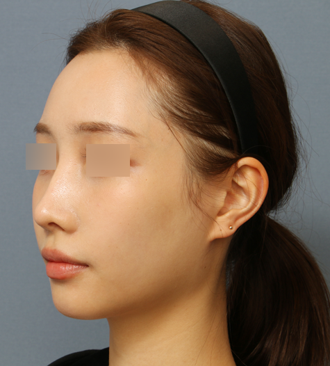 Before 12 45 Degrees