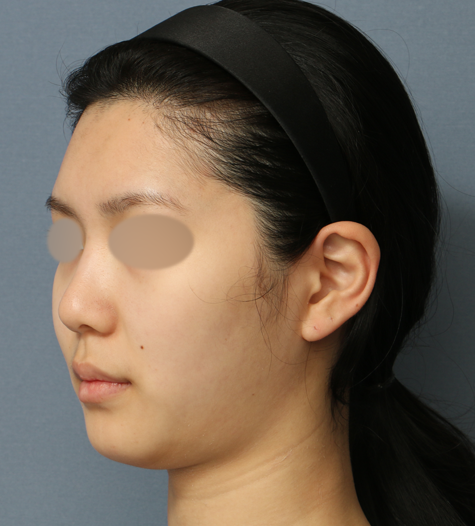 Before 11 45 Degrees