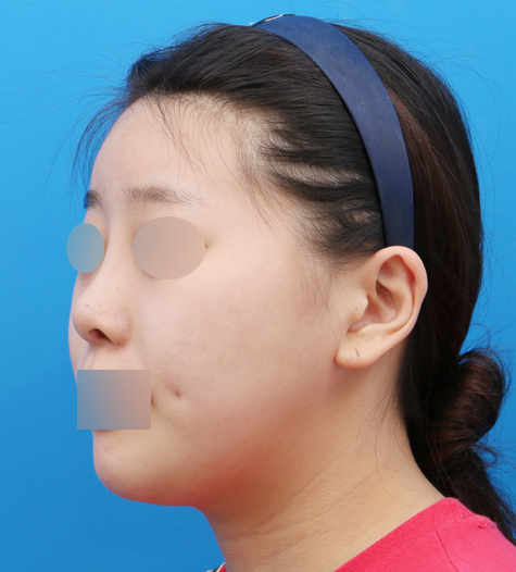 Before 11 45 Degrees