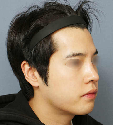 Before 11 45 Degrees