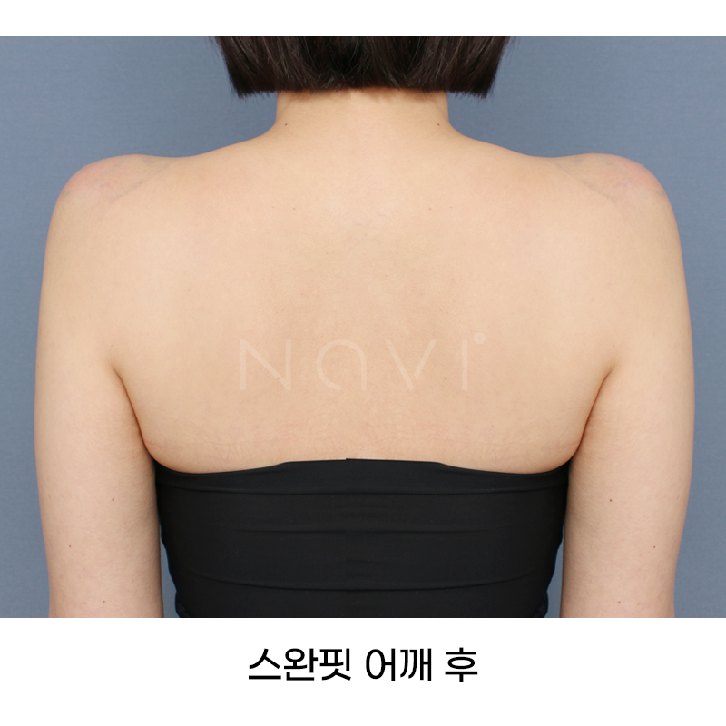 Before 7 Front