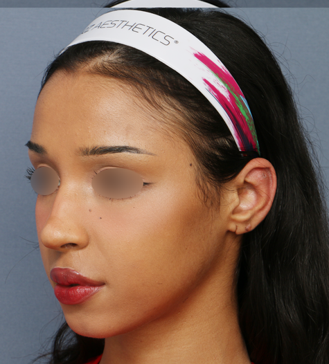 Before 12 45 Degrees