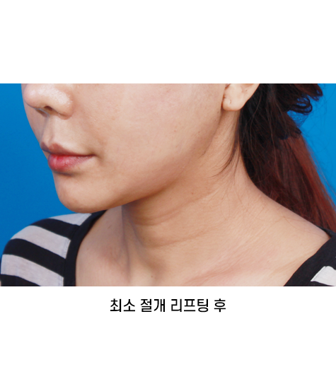 Before 12 45 Degrees