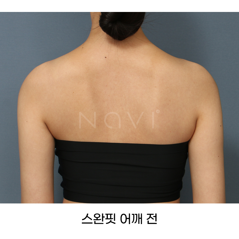Before 3 Front