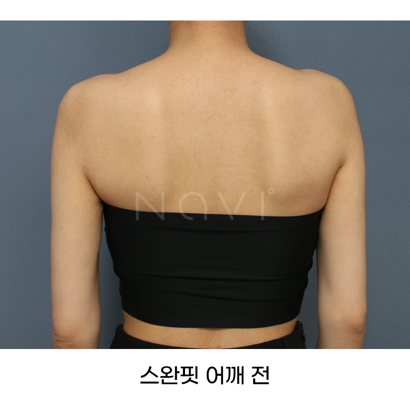 Before 11 Front
