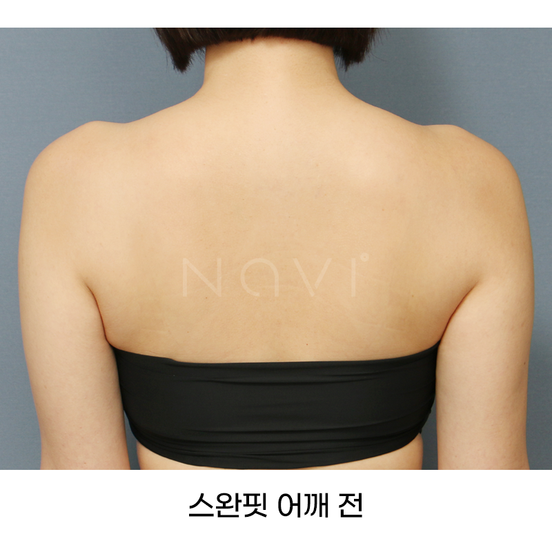 Before 7 Front