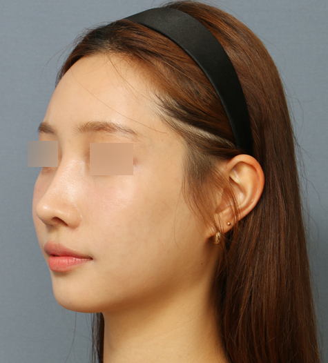 Before 12 45 Degrees