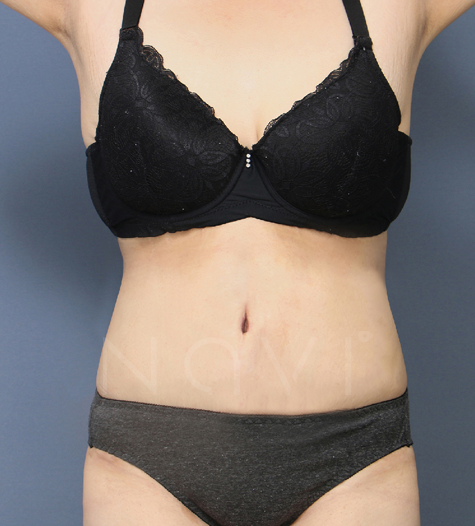 Before 9 Front