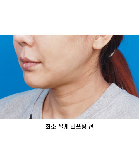 Before 12 45 Degrees