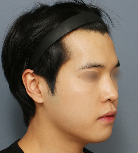 Before 11 45 Degrees