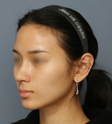 Before 10 45 Degrees