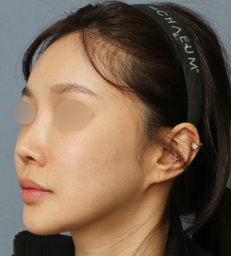 Before 10 45 Degrees